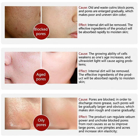Pore Refining – Retinol & Niacinamide Brightening Serum