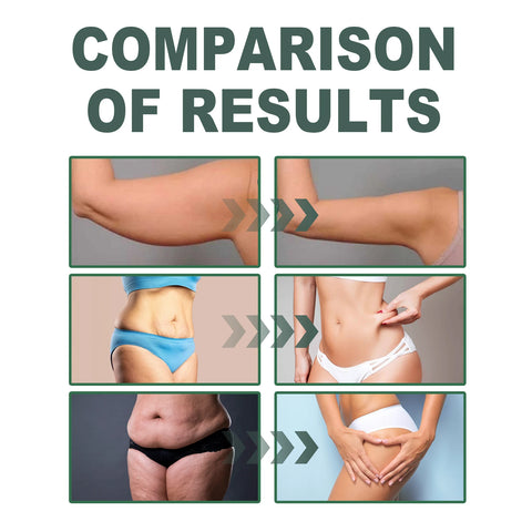 OceAura Collagen Body Oil – Firm Belly, Arms & Skin